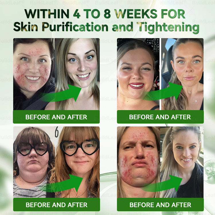 𝑪𝒐𝒏𝒈𝒓𝒂𝒕𝒖𝒍𝒂𝒕𝒊𝒐𝒏𝒔! 𝒀𝒐𝒖’𝒓𝒆 𝒐𝒖𝒓 500𝒕𝒉 𝒄𝒖𝒔𝒕𝒐𝒎𝒆𝒓 𝒕𝒐𝒅𝒂𝒚, 𝒂𝒏𝒅 𝒚𝒐𝒖 𝒈𝒆𝒕 𝒕𝒐 𝒆𝒏𝒋𝒐𝒚 𝒂 𝒔𝒑𝒆𝒄𝒊𝒂𝒍 𝒐𝒇𝒇𝒆𝒓: 𝒂 𝒔𝒆𝒄𝒐𝒏𝒅 𝒑𝒓𝒐𝒅𝒖𝒄𝒕 𝒇𝒐𝒓 30%𝑩𝑳𝑼𝑷𝑼𝑹𝑬 ®